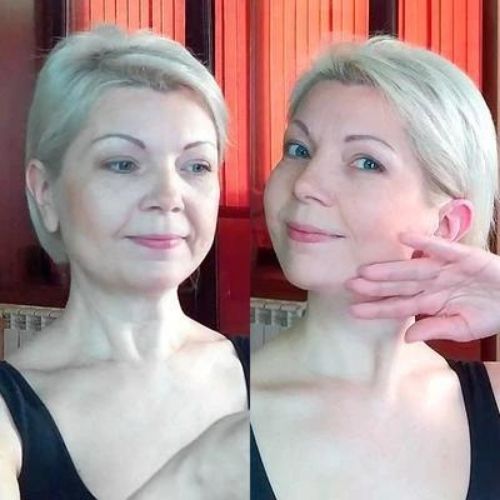 6x mascarilla de barbilla lifting facial